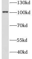 STT3A Antibody - BSA Free
