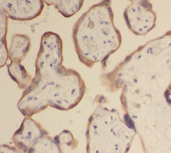 Steroid sulfatase Antibody - BSA Free