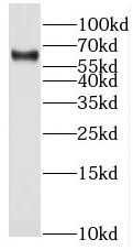 Steroid sulfatase Antibody - BSA Free