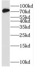 STRBP Antibody - BSA Free