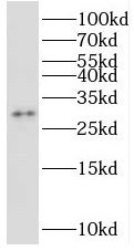 STOML3 Antibody - BSA Free