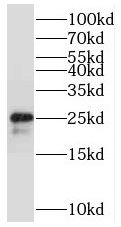 STMN4 Antibody - BSA Free