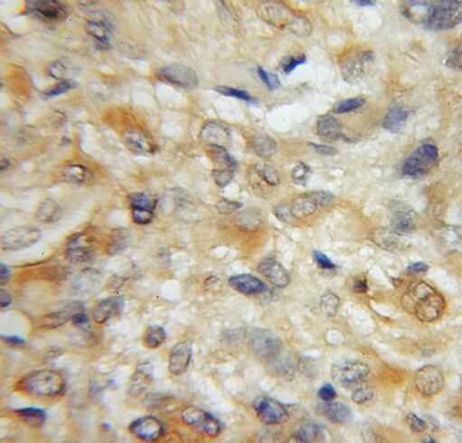 STMN4 Antibody - BSA Free