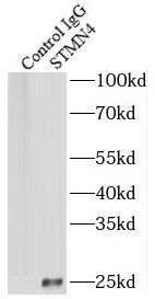 STMN4 Antibody - BSA Free