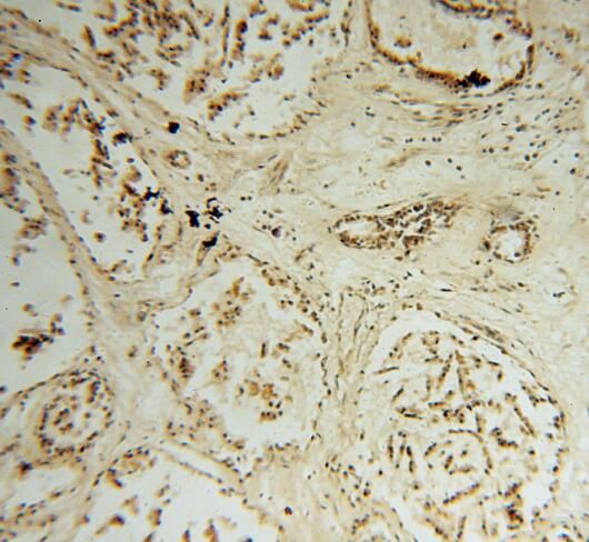 STK36 Antibody - BSA Free
