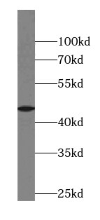 ABRA Antibody - BSA Free