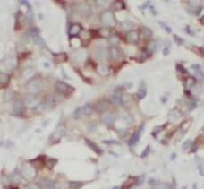 STARD3NL Antibody - BSA Free
