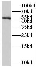 ST3GAL6 Antibody - BSA Free