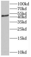 ST3GAL5 Antibody - BSA Free