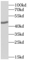 ST3GAL3 Antibody - BSA Free