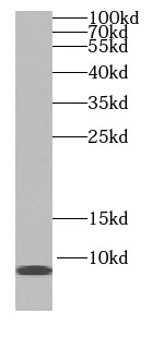 SS18L2 Antibody - BSA Free