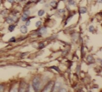 SRXN1 Antibody - BSA Free