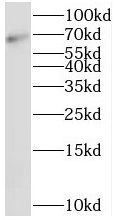 SRP68 Antibody - BSA Free