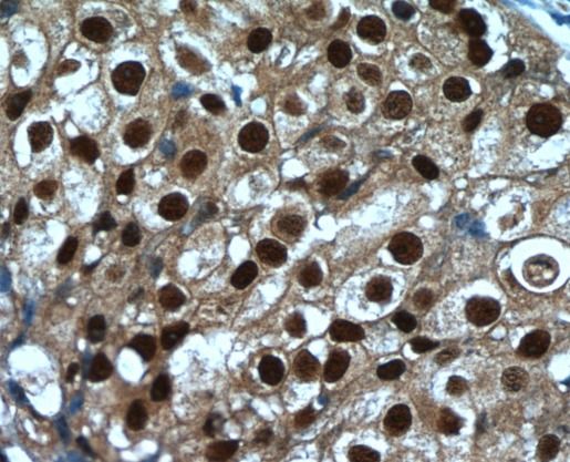 SRA1 Antibody - BSA Free