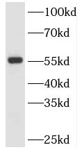 Serine Palmitoyltransferase 2 Antibody - BSA Free