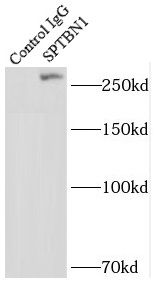 Spectrin beta 2 Antibody - BSA Free
