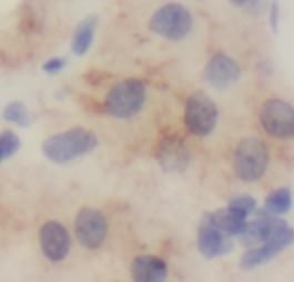 SPRR2F Antibody - BSA Free