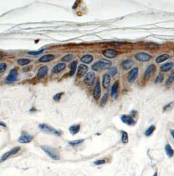 SPRR1B Antibody - BSA Free
