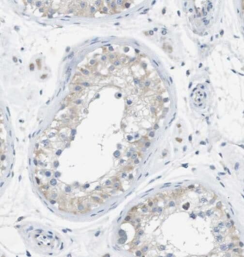 SPPL2a Antibody - BSA Free