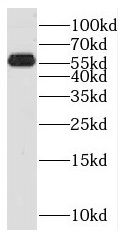 SPPL2a Antibody - BSA Free