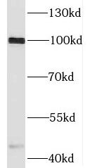 Signal Peptide Peptidase Antibody - BSA Free