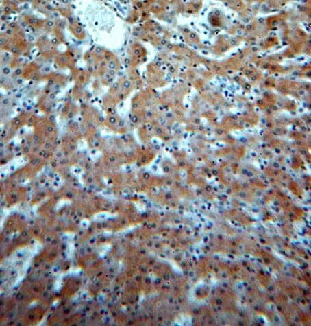 Signal Peptide Peptidase Antibody - BSA Free