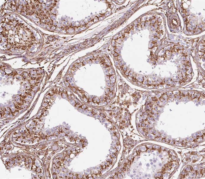 SPATA7 Antibody - BSA Free