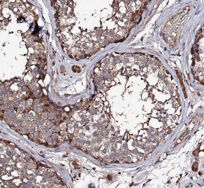 SPATA3 Antibody - BSA Free