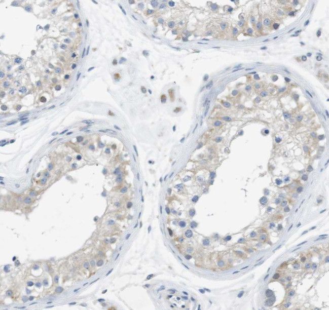 SPATA19 Antibody - BSA Free