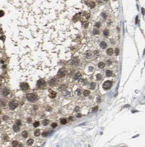 SPANXA1 Antibody - BSA Free