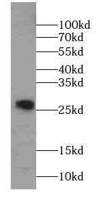 SPANXA1 Antibody - BSA Free
