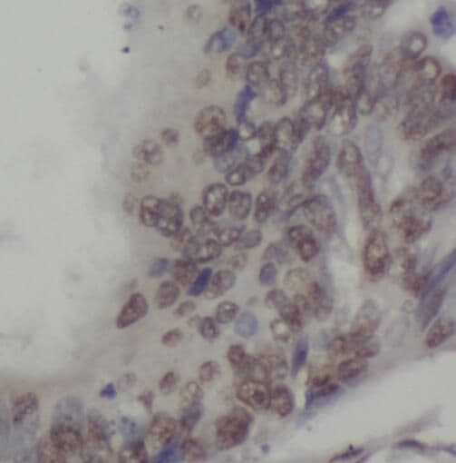 Sperm-associated antigen 7 Antibody - BSA Free