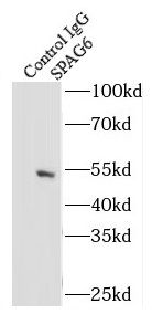 SPAG6 Antibody - BSA Free