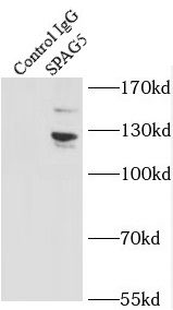 Astrin Antibody - BSA Free