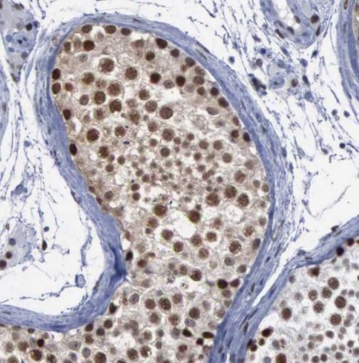 Astrin Antibody - BSA Free