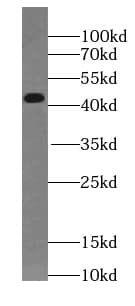 SPAG4L Antibody - BSA Free