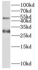 SPACA3 Antibody - BSA Free