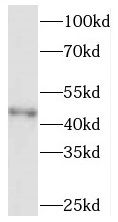SOAT 2 Antibody - BSA Free