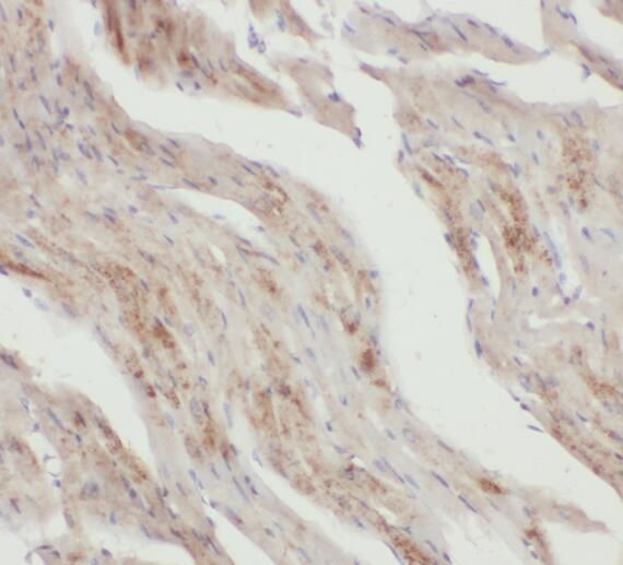 Snx6 Antibody - BSA Free