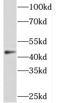 Sorting Nexin 32 Antibody - BSA Free