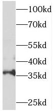 SNX20 Antibody - BSA Free
