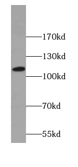 SNX19 Antibody - BSA Free