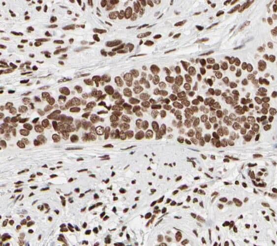 SNRPB2 Antibody - BSA Free