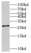 SNRPB2 Antibody - BSA Free