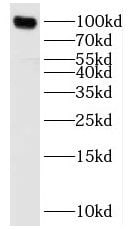 Synphilin-1 Antibody - BSA Free