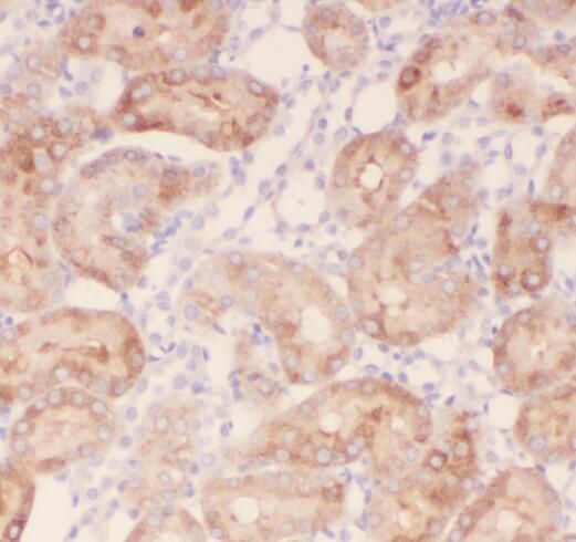 Synphilin-1 Antibody - BSA Free