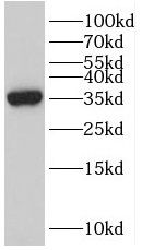 SNAI3 Antibody - BSA Free