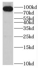 SMYD4 Antibody - BSA Free