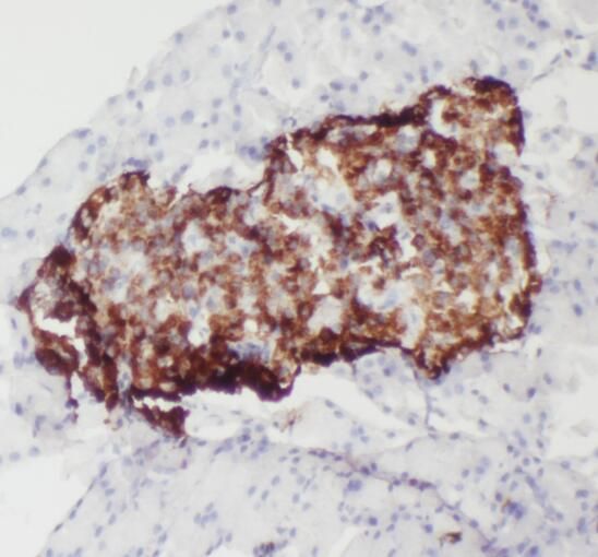 SMYD4 Antibody - BSA Free