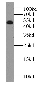 SMTNL1 [p Ser301] Antibody - BSA Free